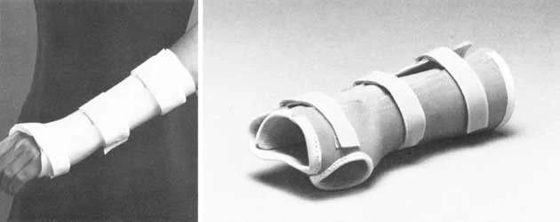 TR2-04-OK Forearm Orthosis Joint Stabilization Support