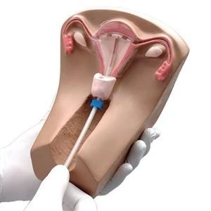 نموذج تدريب على وسائل منع الحمل داخل الرحم GP6624 / B3