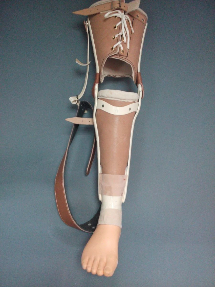 Non-modular hip disarticulation prosthesis