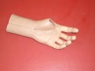Cosmetic Hand Prosthesis PR0-21 for Partial Hand Amputation