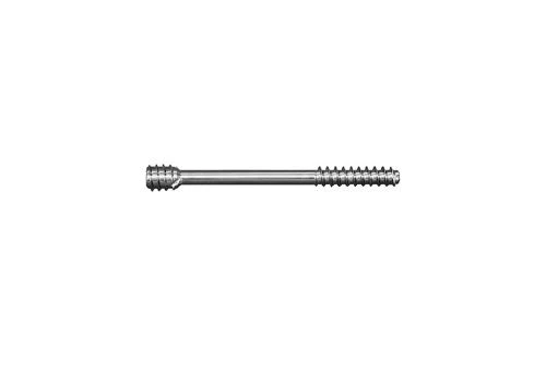 Cannulated Compression Screw for Bone Fragment Stabilization