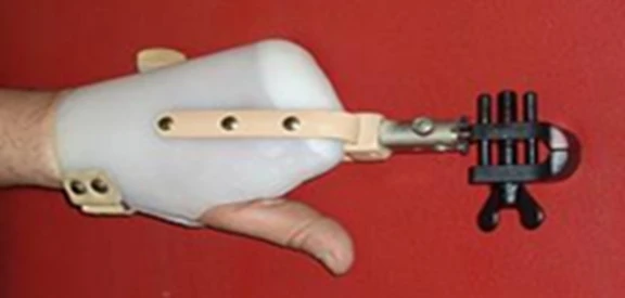 Functional Hand Prosthesis for Individuals with Disabilities