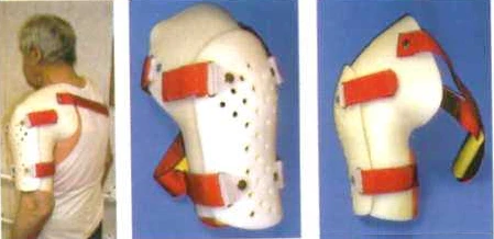 Shoulder Joint Support Brace Custom Fit Left or Right Side