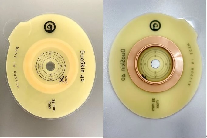 Stoma Rehabilitation Product for Colostomies, Ileostomies, and Urostomies: Flat Plate, Convex Plate
