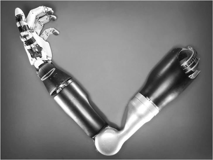 PP9-70-V Powered Upper Limb Prosthesis for Amputation Support