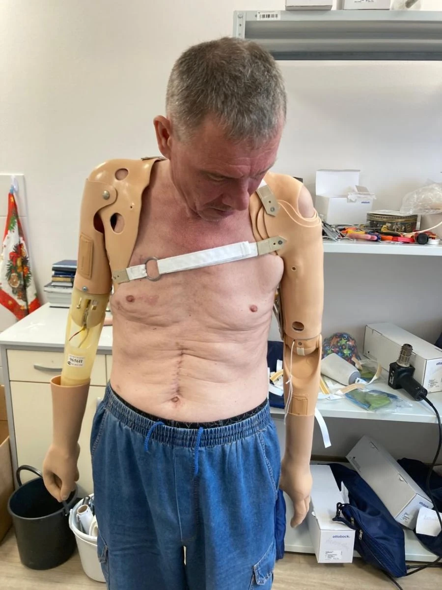 Microprocessor-Controlled Shoulder Prosthesis PR4-MVO