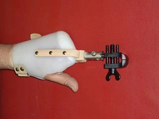 Functional Hand Prosthesis for Partial Hand Amputation PР0-11