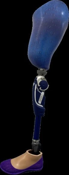 Modular Hip Prosthesis for Congenital Underdevelopment