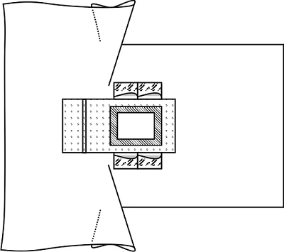 Surgical Field Limiting Sheet for Abdomen and Perineum, Sterile