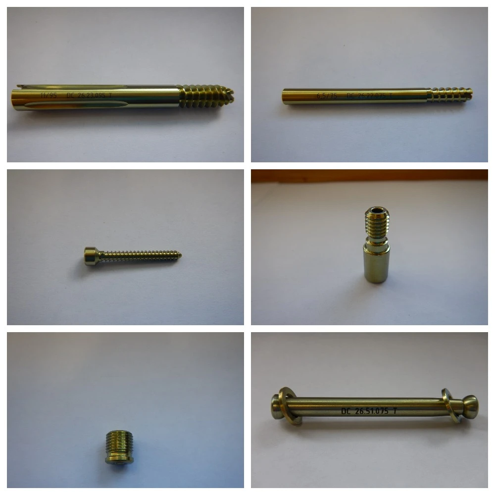 Intramedullary Bone Fracture Implant System for Femur