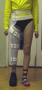 Orthopedic Device for Knee and Hip Joints