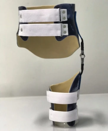 Orthopedic Device for Hip Joint, Model XYZ-123