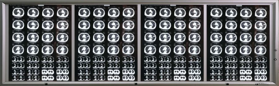 Medical Negatoscope for X-ray and MRI Films - Four-Frame Model